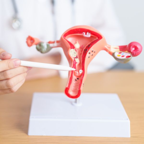 Ενδομητρίωση